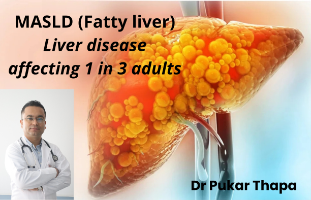 The Liver’s New Name: Why Doctors are Rethinking a Disease Affecting 1 in 3 Adults