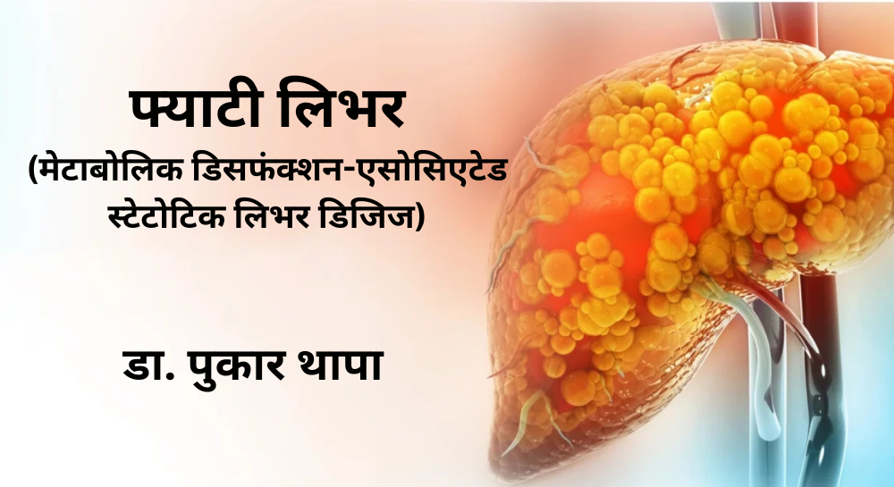 फ्याटी लिभर (मेटाबोलिक डिसफंक्शन-एसोसिएटेड स्टेटोटिक लिभर डिजिज) - (Metabolic Dysfunction-Associated Steatotic Liver Disease - MASLD)